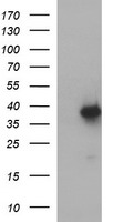 HEK293T cells were transfected with the pCMV6-ENTRY control (Left lane) or pCMV6-ENTRY MCAT (Right lane) cDNA for 48 hrs and lysed. Equivalent amounts of cell lysates (5 ug per lane) were separated by SDS-PAGE and immunoblotted with anti-MCAT.