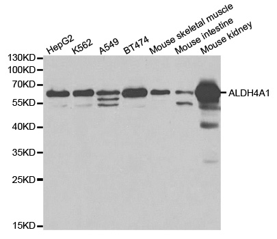 Western blot analysis of extracts of various cell lines, using ALDH4A1 antibody.