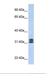 HepG2 cell lysate. Antibody concentration: 1.0 ug/ml. Gel concentration: 12%.