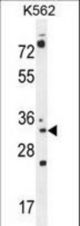 PYCR2 Antibody western blot of K562 cell line lysates (35 ug/lane). The PYCR2 antibody detected the PYCR2 protein (arrow).