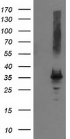 HEK293T cells were transfected with the pCMV6-ENTRY control (Left lane) or pCMV6-ENTRY PYCR2 (Right lane) cDNA for 48 hrs and lysed. Equivalent amounts of cell lysates (5 ug per lane) were separated by SDS-PAGE and immunoblotted with anti-PYCR2.