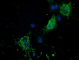 Anti-PYCR2 mouse monoclonal antibody immunofluorescent staining of COS7 cells transiently transfected by pCMV6-ENTRY PYCR2.