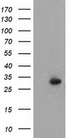 HEK293T cells were transfected with the pCMV6-ENTRY control (Left lane) or pCMV6-ENTRY PYCR2 (Right lane) cDNA for 48 hrs and lysed. Equivalent amounts of cell lysates (5 ug per lane) were separated by SDS-PAGE and immunoblotted with anti-PYCR2.