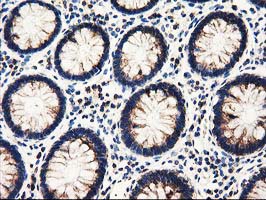 IHC of paraffin-embedded Human colon tissue using anti-PYCR2 mouse monoclonal antibody.