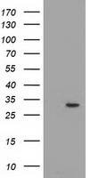 HEK293T cells were transfected with the pCMV6-ENTRY control (Left lane) or pCMV6-ENTRY PYCR2 (Right lane) cDNA for 48 hrs and lysed. Equivalent amounts of cell lysates (5 ug per lane) were separated by SDS-PAGE and immunoblotted with anti-PYCR2.