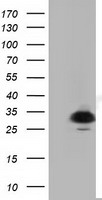 HEK293T cells were transfected with the pCMV6-ENTRY control (Left lane) or pCMV6-ENTRY PYCR2 (Right lane) cDNA for 48 hrs and lysed. Equivalent amounts of cell lysates (5 ug per lane) were separated by SDS-PAGE and immunoblotted with anti-PYCR2.