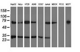 Western blot of extracts (35 ug) from 9 different cell lines by using anti-PYCR2 monoclonal antibody.