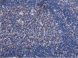 IHC of paraffin-embedded Human lymph node tissue using anti-PYCR2 mouse monoclonal antibody.