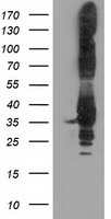 HEK293T cells were transfected with the pCMV6-ENTRY control (Left lane) or pCMV6-ENTRY PYCR2 (Right lane) cDNA for 48 hrs and lysed. Equivalent amounts of cell lysates (5 ug per lane) were separated by SDS-PAGE and immunoblotted with anti-PYCR2.