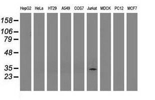 Western blot of extracts (35 ug) from 9 different cell lines by using anti-PYCR2 monoclonal antibody.