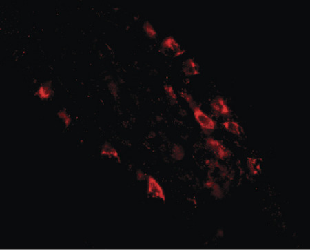 Immunofluorescence of rkhd1 in human small intestine tissue with rkhd1 antibody at 20 ug/ml.