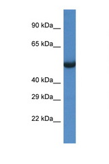 SESN1 antibody LS-C145280 Western blot of Rat Brain lysate. Antibody concentration 1 ug/ml.
