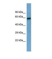 Western blot of Human THP-1. SESN1 antibody dilution 1.0 ug/ml.