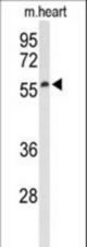 Western blot of Sestrin-1 Antibody in mouse heart tissue lysates (35 ug/lane). Sestrin-1 (arrow) was detected using the purified antibody.