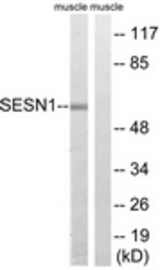 Western blot of extracts from rat muscle cells, using SESN1 Antibody. The lane on the right is treated with the synthesized peptide.