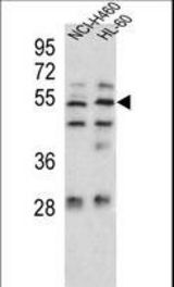 Sestrin-1 Antibody western blot of NCI-H460,HL-60 cell line lysates (35 ug/lane). The Sestrin-1 antibody detected the Sestrin-1 protein (arrow).