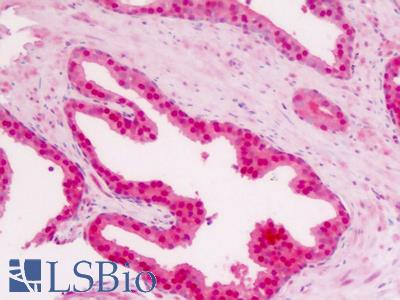 Anti-PA26 / SESN1 antibody IHC staining of human prostate, epithelium. Immunohistochemistry of formalin-fixed, paraffin-embedded tissue after heat-induced antigen retrieval.