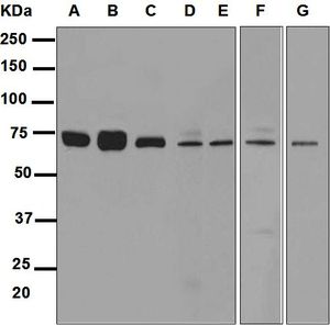 Western blot analysis on (A) Ramos, (B) K562, (C) HeLa, (D) C2C12, (E) NIH/3T3, (F) F9, and (G) JAR cell lysates using anti-Sestrin-1 antibody.