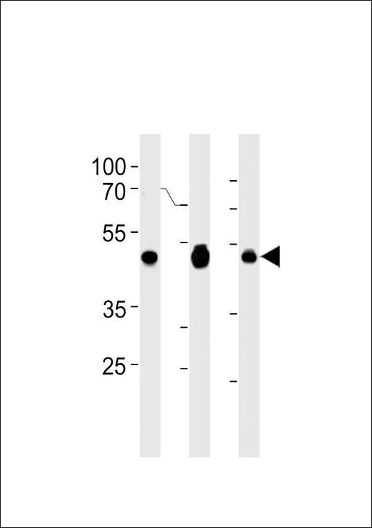 EBP1 Antibody western blot of A2058,Jurkat,MCF-7 cell line lysates (35 ug/lane). The EBP1 antibody detected the EBP1 protein (arrow).