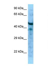 MFAP1 antibody LS-C146283 Western blot of Mouse Pancreas lysate. Antibody concentration 1 ug/ml.