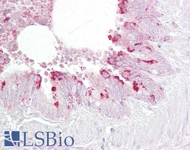 Anti-EBP1 antibody IHC of human lung, respiratory epithelium. Immunohistochemistry of formalin-fixed, paraffin-embedded tissue after heat-induced antigen retrieval. Antibody LS-B6878 concentration 5 ug/ml.