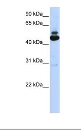 293T cell lysate. Antibody concentration: 1.0 ug/ml. Gel concentration: 12%.