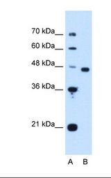 Lane A: Marker. Lane B: HepG2 cell lysate. Antibody concentration: 1.25 ug/ml. Gel concentration: 12%.