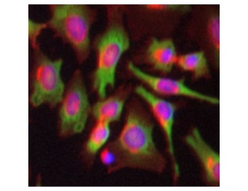 Immunocytochemistry/ Immunofluorescence-PABP antibody [10E10] stained HeLa cells