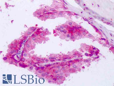 Anti-PABPC1 / PABP1 antibody IHC of human prostate. Immunohistochemistry of formalin-fixed, paraffin-embedded tissue after heat-induced antigen retrieval. Antibody LS-B8470 dilution 5-10 ug/ml.