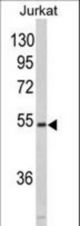 Western blot of MFAP1 in Jurkat cell line lysates (35 ug/lane). MFAP1 (arrow) was detected using the purified antibody.