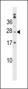 PABPC1L2B Antibody western blot of K562 cell line lysates (35 ug/lane). The PABPC1L2B antibody detected the PABPC1L2B protein (arrow).