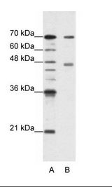 A: Marker, B: HepG2 Cell Lysate