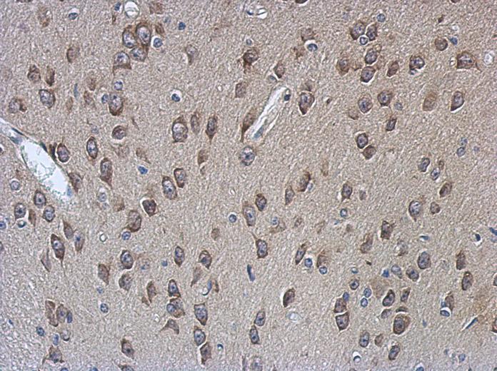 IHC of paraffin-embedded CL1-5 xenograft, using PABPC4 antibody antibody at 1:500 dilution.