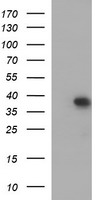 HEK293T cells were transfected with the pCMV6-ENTRY control (Left lane) or pCMV6-ENTRY MCAT (Right lane) cDNA for 48 hrs and lysed. Equivalent amounts of cell lysates (5 ug per lane) were separated by SDS-PAGE and immunoblotted with anti-MCAT.