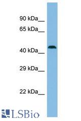 MBTD1 antibody Western Blot of NCI-H226. Antibody dilution: 1 ug/ml.