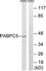 Western blot of extracts from K562 cells, using PABPC5 Antibody. The lane on the right is treated with the synthesized peptide.