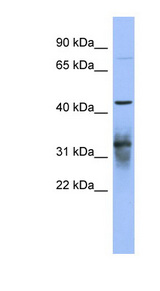 PABPC5 antibody LS-C110605 Western blot of NCI-H226 cell lysate.