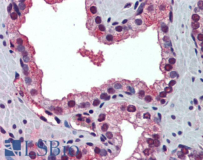 Anti-PABPN1 antibody IHC of human prostate. Immunohistochemistry of formalin-fixed, paraffin-embedded tissue after heat-induced antigen retrieval. Antibody LS-B5706 concentration 5 ug/ml.