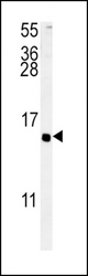 ADCYAP1 Antibody western blot of 293 cell line lysates (35 ug/lane). The ADCYAP1 antibody detected the ADCYAP1 protein (arrow).