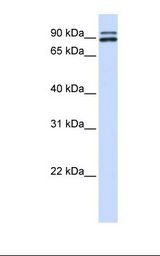 Fetal brain lysate. Antibody concentration: 1.0 ug/ml. Gel concentration: 12%.