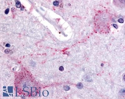 Anti-PACE4 antibody LS-A7857 IHC of human brain, cortex. Immunohistochemistry of formalin-fixed, paraffin-embedded tissue after heat-induced antigen retrieval.