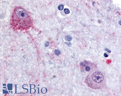 Anti-PACE4 antibody LS-A8407 IHC of human brain, cortex. Immunohistochemistry of formalin-fixed, paraffin-embedded tissue after heat-induced antigen retrieval.