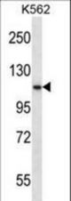 PCSK6 Antibody western blot of K562 cell line lysates (35 ug/lane). The PCSK6 antibody detected the PCSK6 protein (arrow).