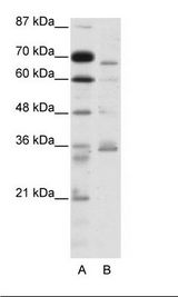 A: Marker, B: HepG2 Cell Lysate