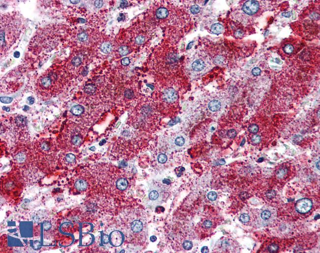 Anti-PACE4 antibody LS-A7952 IHC of human liver. Immunohistochemistry of formalin-fixed, paraffin-embedded tissue after heat-induced antigen retrieval.