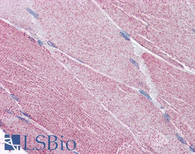 Anti-PACE4 antibody IHC of human skeletal muscle. Immunohistochemistry of formalin-fixed, paraffin-embedded tissue after heat-induced antigen retrieval. Antibody LS-B4377 concentration 5 ug/ml.