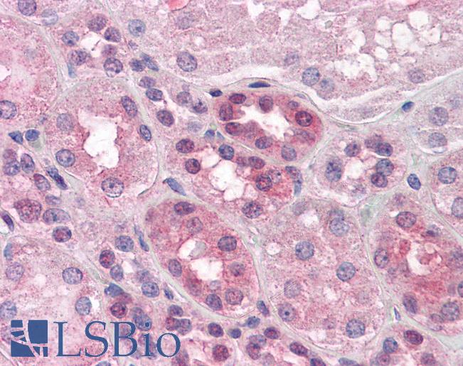 Anti-PACE4 antibody IHC of human kidney. Immunohistochemistry of formalin-fixed, paraffin-embedded tissue after heat-induced antigen retrieval. Antibody LS-B4377 concentration 5 ug/ml.