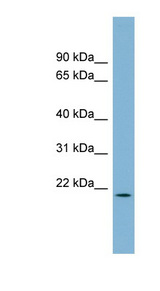 PACRGL antibody LS-C108025 Western blot of Fetal Small Intestine lysate.
