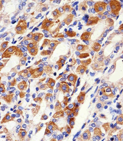 Immunohistochemical of paraffin-embedded H.stomach section using PACSIN2 Antibody. Antibody was diluted at 1:100 dilution. A peroxidase-conjugated goat anti-rabbit IgG at 1:400 dilution was used as the secondary antibody, followed by DAB staining.