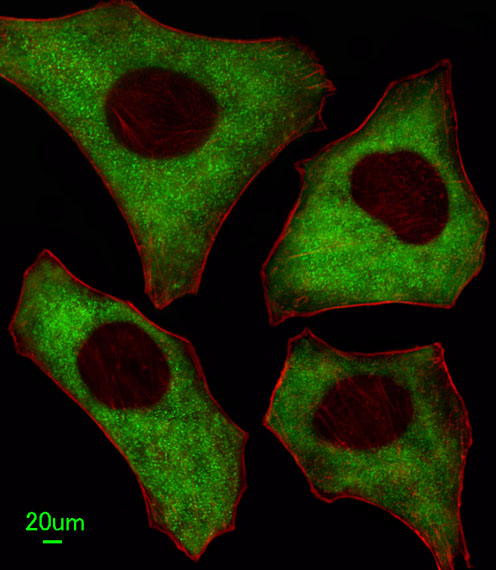 Immunofluorescent of HeLa cells, using PACSIN2 Antibody. Antibody was diluted at 1:100 dilution. Alexa Fluor 488-conjugated goat anti-rabbit lgG at 1:400 dilution was used as the secondary antibody (green). Cytoplasmic actin was counterstained with Dylight Fluor 554 (red) conjugated Phalloidin (red).